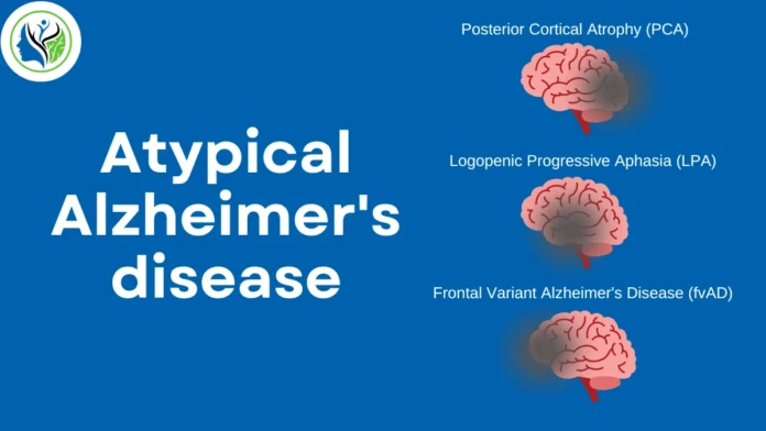 Alzheimer's progression