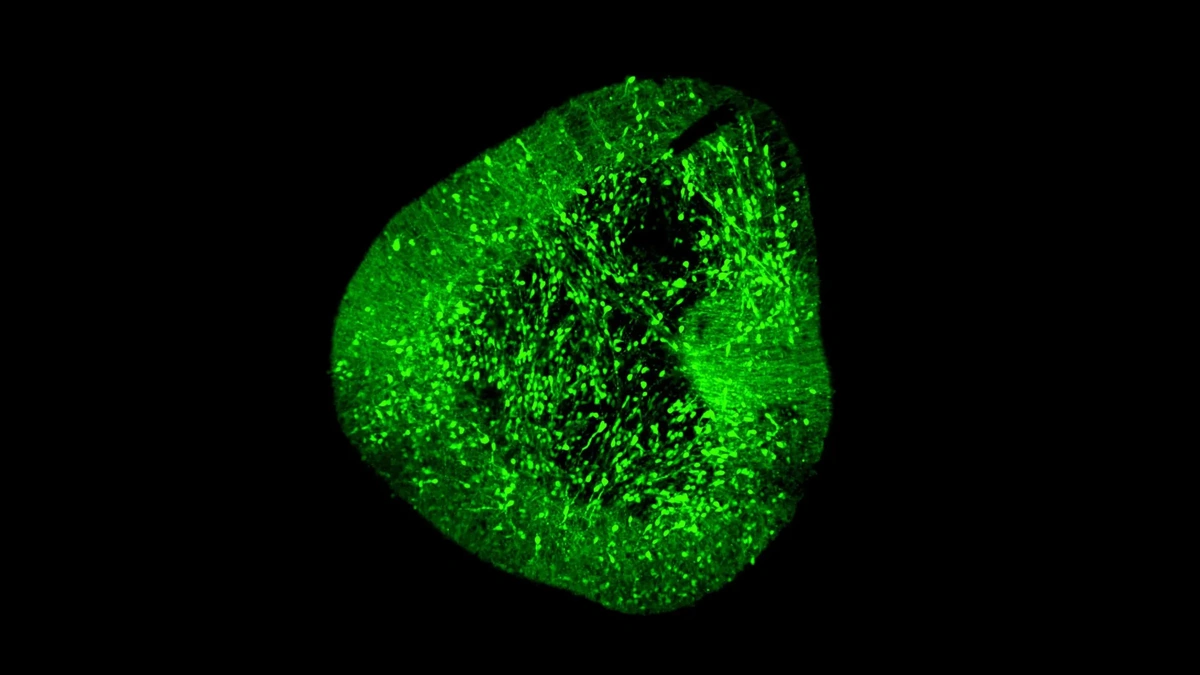 Why This Brain Map Matters