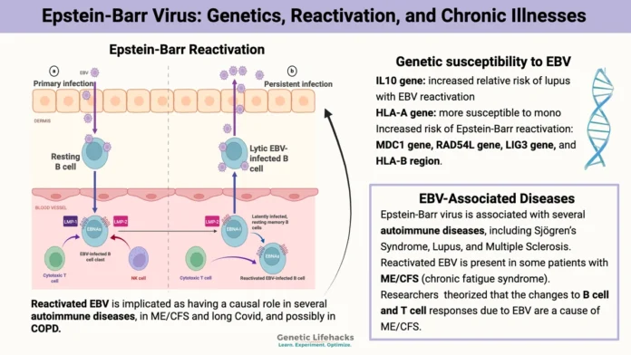 Epstein-Barr Virus Lupus Trigger
