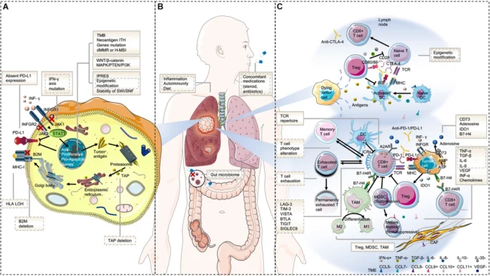 Immunotherapy Resistance