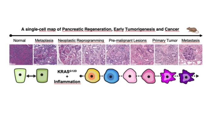 reprogram pancreas